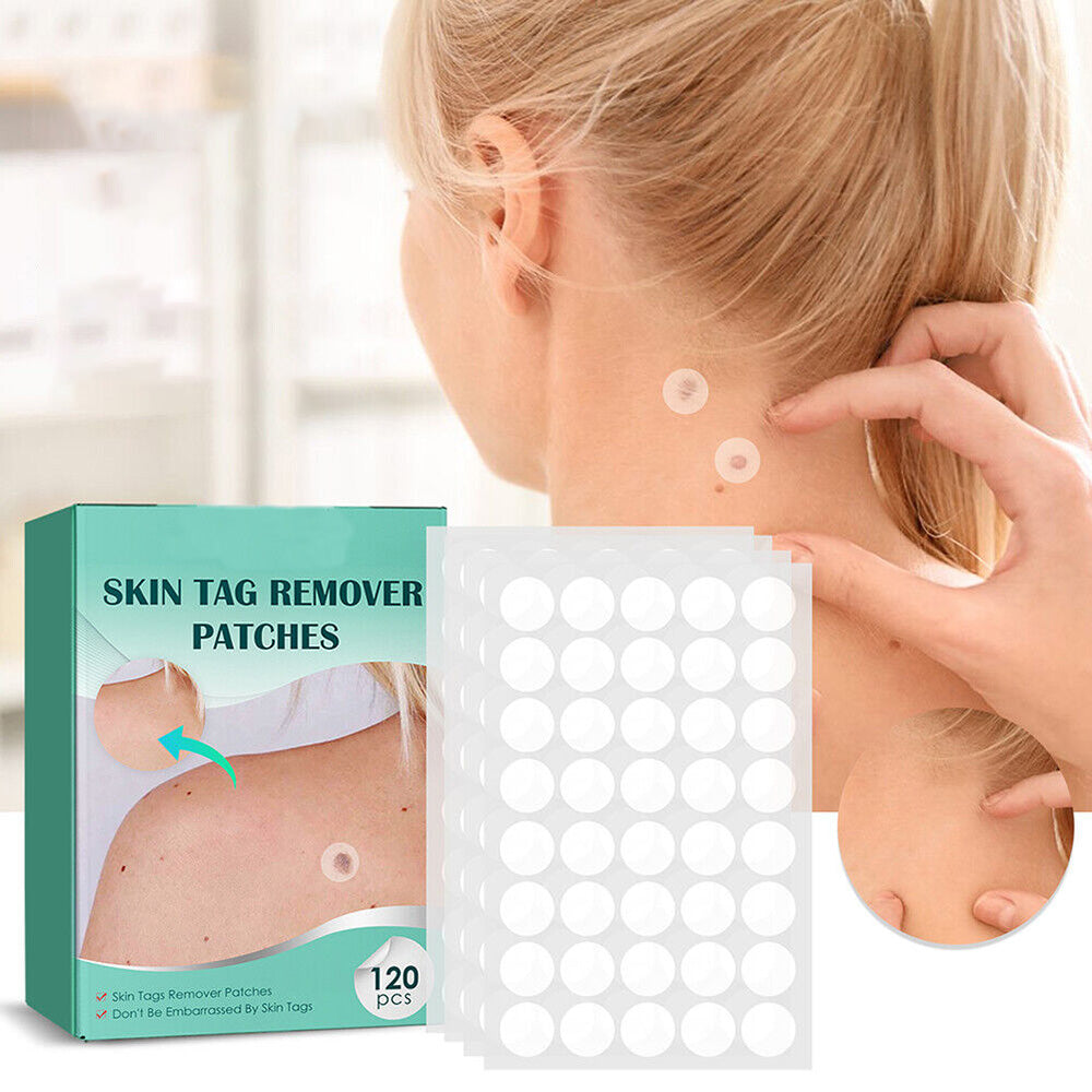 DermaClear – Effektives Behandlungset für Akne und Warzen