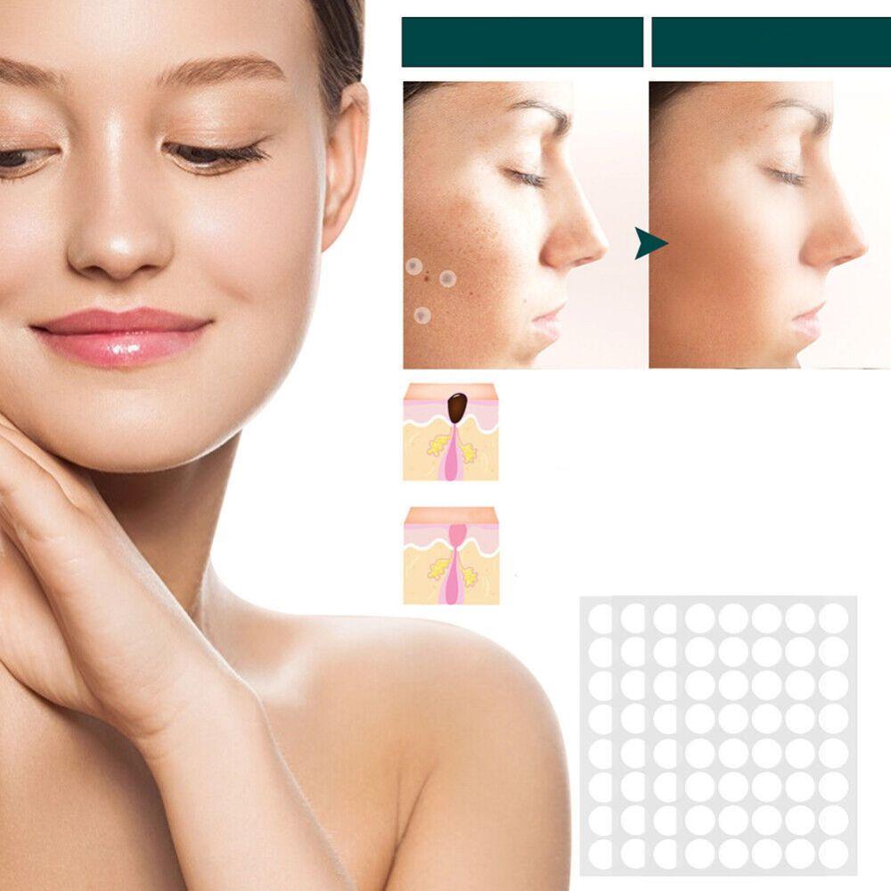 DermaClear – Effektives Behandlungset für Akne und Warzen