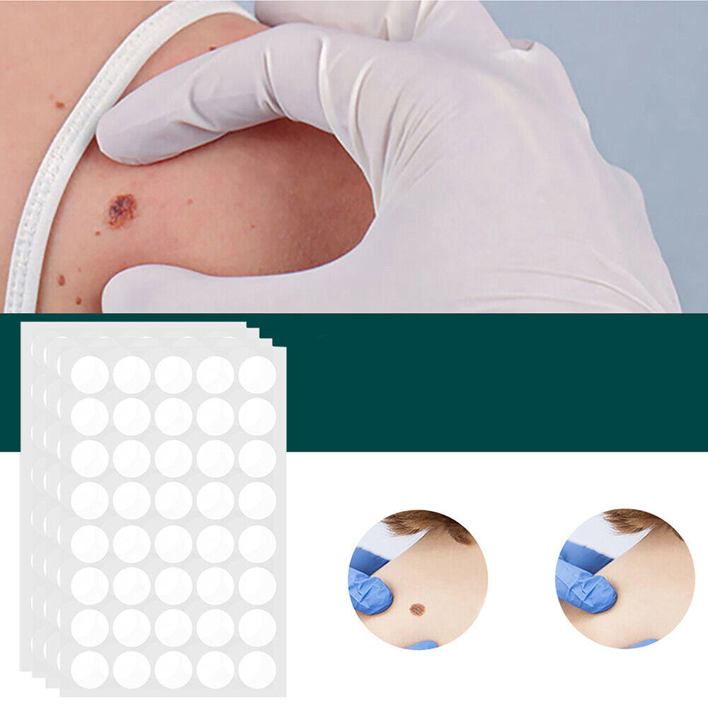 DermaClear – Effektives Behandlungset für Akne und Warzen