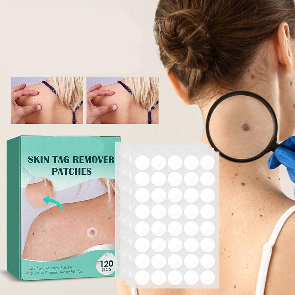 DermaClear – Effektives Behandlungset für Akne und Warzen